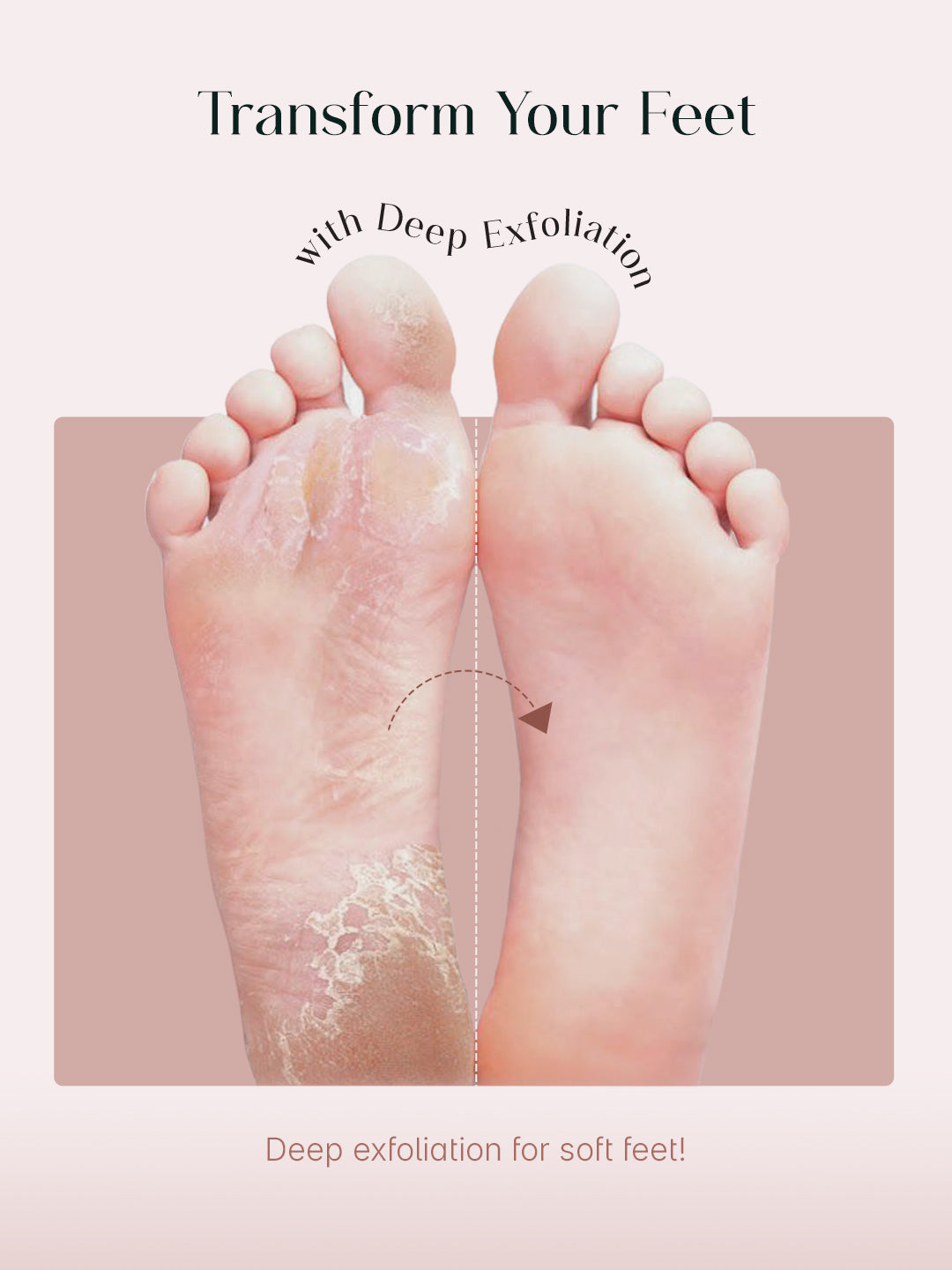 SeoulSkin Glycolic Acid Foot Mask