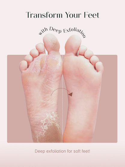 SeoulSkin Glycolic Acid Foot Mask